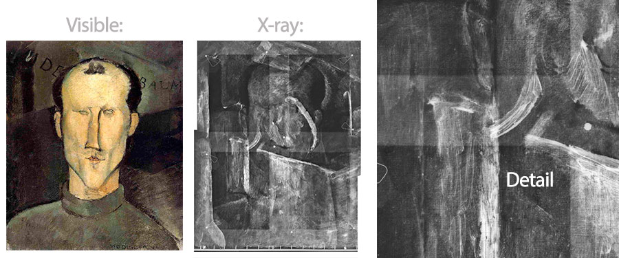 x ray detail