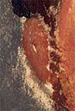 DETAIL OF THE CONSTRUCTION OF THE EARS OF LEON BAKST BY AMEDEO MODIGLIANI
