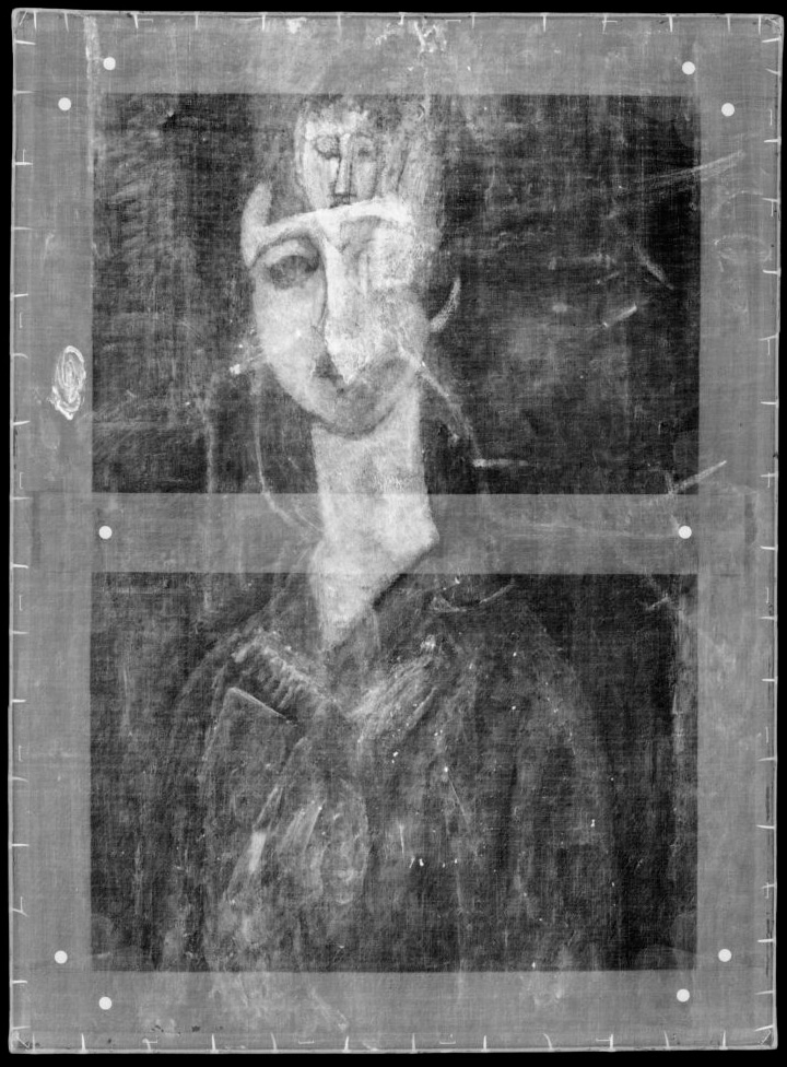 x-ray of Victoria